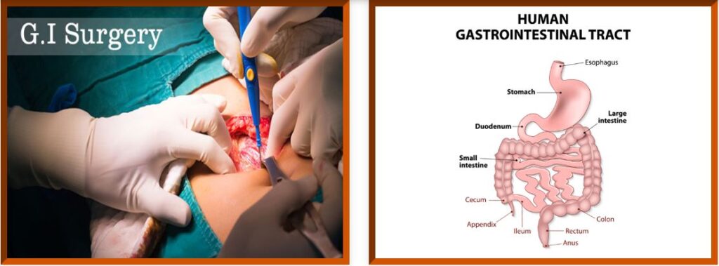 Gastrointestinal Surgery