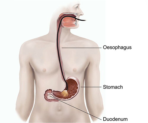 Advanced endoscopy