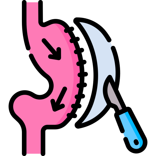 Partial Gastrectomy